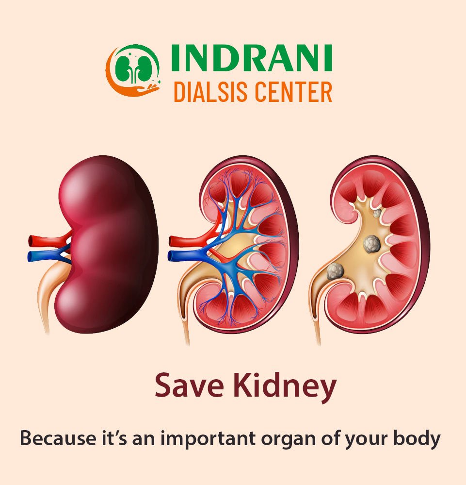 news-updates-dialsis